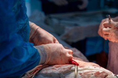 Bir cerrah bir hastanın vücudunu kesiyor. Cerrah hassas ve potansiyel olarak hayat kurtaran bir prosedür uygularken sahne yoğun ve dramatik. Hasta büyük ihtimalle çok acı çekiyor.