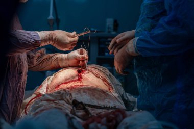 Bir adam bir kadının karnını deşiyor. Kadının kanaması var. Adam eldiven takıyor.