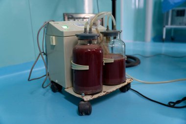 Üzerine iki tüp bağlanmış tıbbi bir cihaz. Tüpler kırmızı sıvıyla dolu. Cihaz mavi bir yüzeyde.