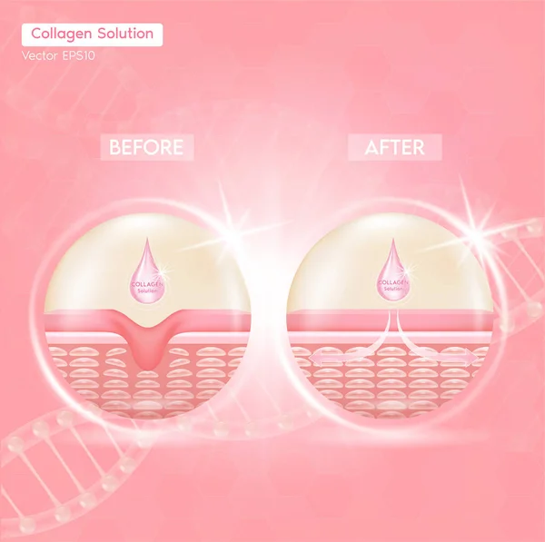 Cilt solüsyonundan önce ve sonra kolajen çözeltisinin yardımıyla cilt gençleştirme süreci, kolajen serumu kozmetik reklam arka planına sahip düşer. Vektör EPS10.