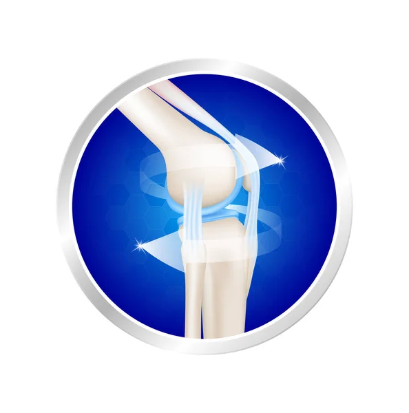 Etiqueta Hueso Aluminio Saludable Con Flecha Alrededor Vista Lateral Articulación — Vector de stock