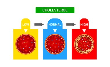 HDL yüksek yoğunluklu lipoprotein ve LDL düşük yoğunluklu lipoprotein ile kolesterol metre veya ölçek karşılaştırması. Normal kan akışı ve kolesterol arter trombozu hastalığı. İlaç ve Sağlık Vektörü.
