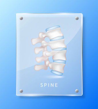 İnsan omurgası, eczane reklamı için şeffaf cam paneller. Klinikler için afiş tasarımı, hastane. Tıp bilimi konsepti. Gerçekçi 3B Vektör.