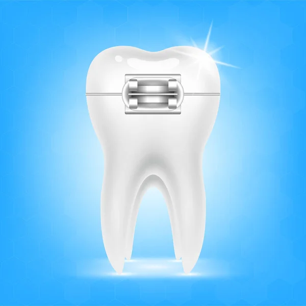 Orthodontic Treatment Style Fashion Beautiful Blue White Teeth Metal Brackets — Stock Vector