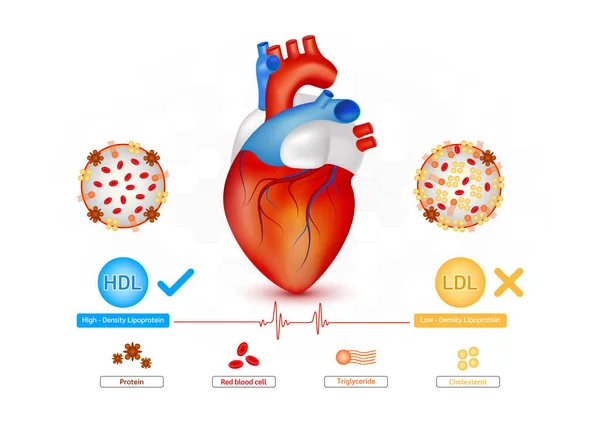 Test Sanguin Médical Cholestérol Dans Cœur Humain Comparaison Échelle Cholestérol — Image vectorielle