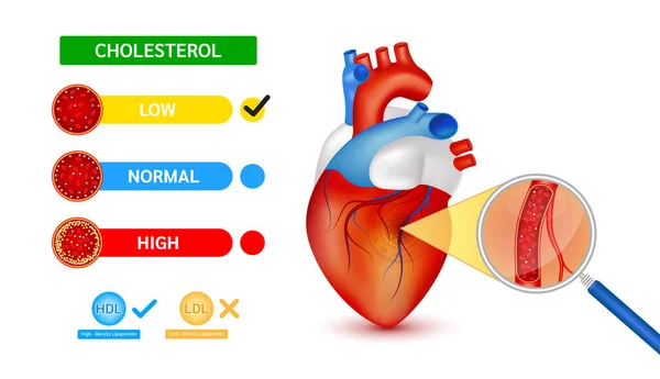 Tes Darah Medis Menggunakan Skala Kolesterol Kaca Pembesaran Dibandingkan Dengan - Stok Vektor