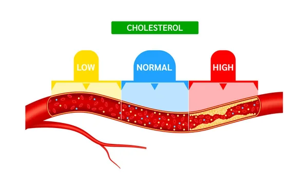 Hdl高密度リポタンパク質およびLdl低密度リポタンパク質とのコレステロール計またはスケール比較 正常な血流とコレステロール動脈血栓症の病気 医学と健康 Vector — ストックベクタ