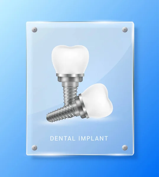 Dental Implant Square Translucent Glass Panels Pharmacy Advertisement Poster Banner — Stock Vector