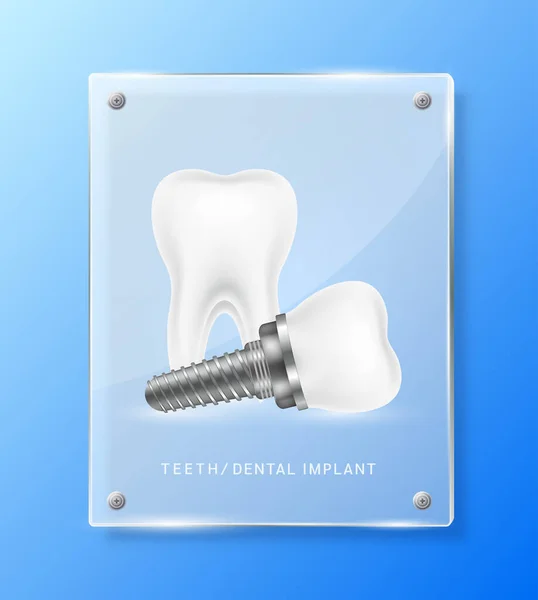Implante Dentário Dentes Dentro Painéis Vidro Translúcidos Quadrados Para Propaganda — Vetor de Stock