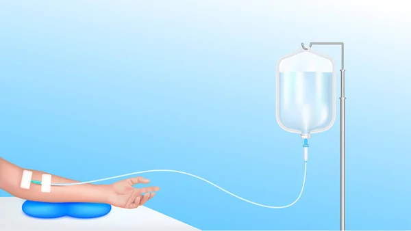 盐水袋滴注和手治疗病人 维生素Iv静脉注射护理化疗 医疗和保健概念 蓝色背景矢量的真实感3D — 图库矢量图片
