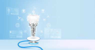 Tooth dental implant float away from stethoscope. Image virtual hologram through screen computer. Doctor diagnose digital data record on electronic medical. Technology innovation. 3d Vector.