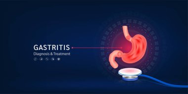 Mide iltihabı, insan mide modeli steteskoptan uzaklaşır. Doktor teşhisi. Tıbbi teknoloji yenilik kavramı. Eczane kliniği için pankart tasarımı. 3d Vektör.