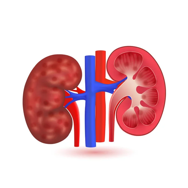 Chronic Kidney Disease Human Kidneys Red Model Isolated White Background — Stock Vector