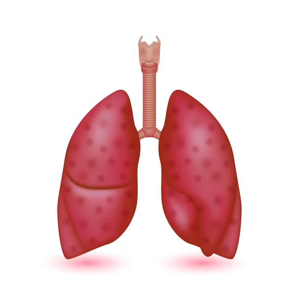 肺炎結核病 ヒト肺解剖学モデルは白地に単離された 人体の主な器官 医学と科学の概念 3Dベクトル — ストックベクタ