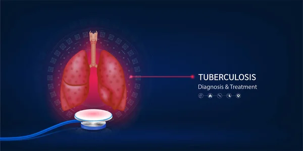 Заболевание Туберкулезом Пневмонитом Модель Человеческих Легких Уплывает Стетоскопа Диагностическое Лечение — стоковый вектор