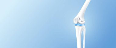 Eklem hasarından sonra eklem iltihabından kurtulmak için tam diz protezi ya da implant. Bacak kemiği ve kıkırdak tarafı metin için kopyalama alanı. Tıbbi sağlık bilimi teknolojisi konsepti. 3B vektör.