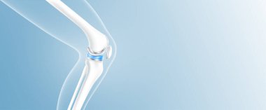 Eklem hasarından sonra eklem iltihabından kurtulmak için tam diz protezi ya da implant. Bacak kemiği ve kıkırdak tarafı metin için kopyalama alanı. Tıbbi sağlık bilimi teknolojisi konsepti. 3B vektör.