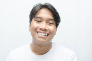 Young Asian Man Smiling and Showing His Crooked Teeth Isolated Over White Background. Dracula Teeth and Bucktooth Concept clipart