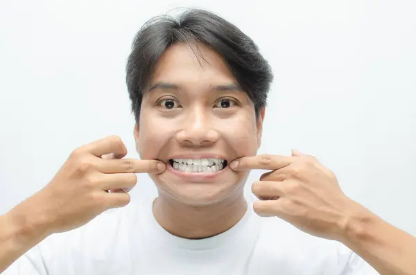 Eğri dişlerini beyaz arka planda gösterip gülümseyen genç Asyalı adam. Drakula Dişleri ve Bucktooth Kavramı
