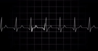 EKG kalp atışı, 4K 'deki siyah arkaplan animasyonunu gösteriyor. Tıbbi monitör kardiyografi nabız kontrolü elektronik ekran görüntüleme makinesi gösteriyor. Kardiyogram nube hızı ecg dalgaboyu ameliyatı.