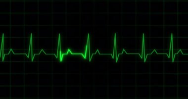 EKG kalp atışı, 4K 'deki siyah arkaplan animasyonunu gösteriyor. Tıbbi monitör kardiyografi nabız kontrolü elektronik ekran görüntüleme makinesi gösteriyor. Kardiyogram nube hızı ecg dalgaboyu ameliyatı.