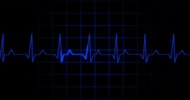 EKG kalp atışı, 4K 'deki siyah arkaplan animasyonunu gösteriyor. Tıbbi monitör kardiyografi nabız kontrolü elektronik ekran görüntüleme makinesi gösteriyor. Kardiyogram nube hızı ecg dalgaboyu ameliyatı.