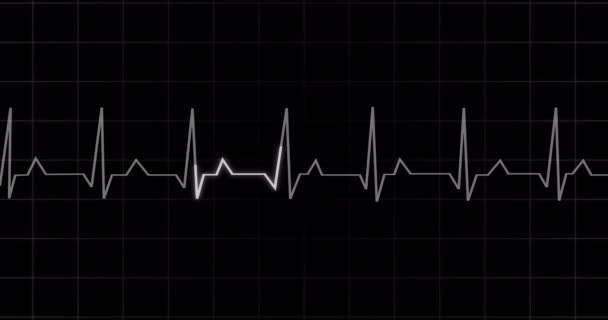 Ekg Heartbeat Lettura Animazione Sfondo Nero Monitor Medico Che Visualizza — Video Stock
