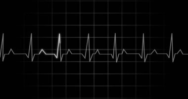 EKG kalp atışı siyah arka planda animasyon okuyor. Tıbbi monitör kardiyografi nabız kontrolü elektronik ekran görüntüleme makinesi gösteriyor. Kardiyogram nube hızı ecg dalgaboyu ameliyatı.