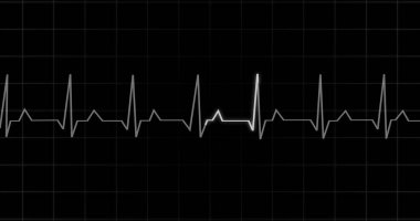 EKG kalp atışı siyah arka planda animasyon okuyor. Tıbbi monitör kardiyografi nabız kontrolü elektronik ekran görüntüleme makinesi gösteriyor. Kardiyogram nube hızı ecg dalgaboyu ameliyatı.
