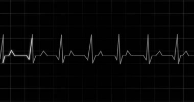 EKG kalp atışı siyah arka planda animasyon okuyor. Tıbbi monitör kardiyografi nabız kontrolü elektronik ekran görüntüleme makinesi gösteriyor. Kardiyogram nube hızı ecg dalgaboyu ameliyatı.