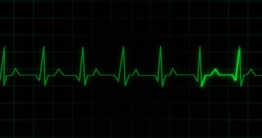 EKG kalp atışı siyah arka planda animasyon okuyor. Tıbbi monitör kardiyografi nabız kontrolü elektronik ekran görüntüleme makinesi gösteriyor. Kardiyogram nube hızı ecg dalgaboyu ameliyatı.