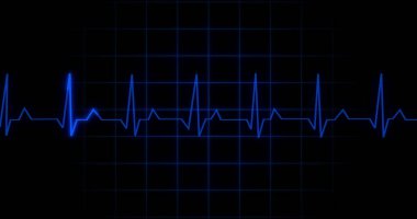 EKG kalp atışı siyah arka planda animasyon okuyor. Tıbbi monitör kardiyografi nabız kontrolü elektronik ekran görüntüleme makinesi gösteriyor. Kardiyogram nube hızı ecg dalgaboyu ameliyatı.