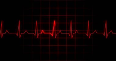 EKG kalp atışı siyah arka planda animasyon okuyor. Tıbbi monitör kardiyografi nabız kontrolü elektronik ekran görüntüleme makinesi gösteriyor. Kardiyogram nube hızı ecg dalgaboyu ameliyatı.
