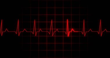 EKG kalp atışı siyah arka planda animasyon okuyor. Tıbbi monitör kardiyografi nabız kontrolü elektronik ekran görüntüleme makinesi gösteriyor. Kardiyogram nube hızı ecg dalgaboyu ameliyatı.
