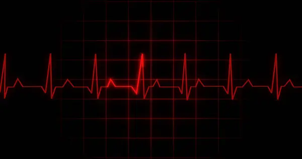 EKG kalp atışı siyah arka planda animasyon okuyor. Tıbbi monitör kardiyografi nabız kontrolü elektronik ekran görüntüleme makinesi gösteriyor. Kardiyogram nube hızı ecg dalgaboyu ameliyatı.