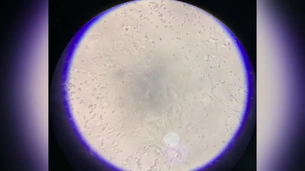 Spermatozoi Umani Microscopio Ingrandimento 40X Macro Vista Attraverso Microscopio Diapositiva — Video Stock