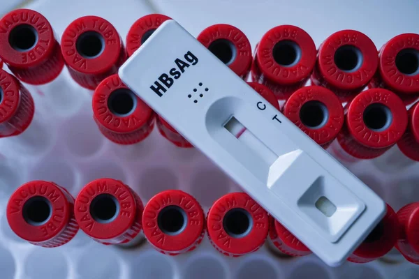 Rapid test cassette for Hepatitis B Virus Test (HBsAg) on a above the red vacuum tube. shows a negative result.Copy space