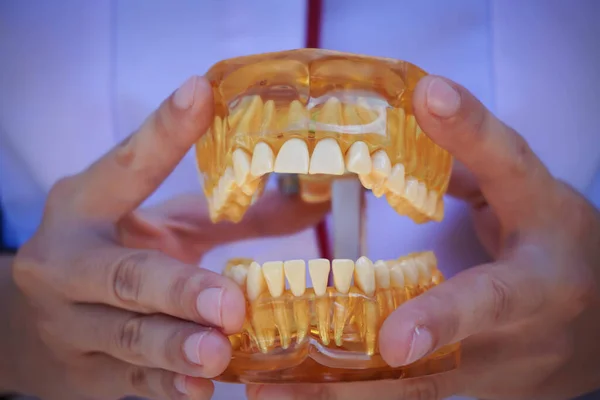 The doctors hands hold an artificial model of the jaw with breaks. The dentist shows an example of tooth alignment.