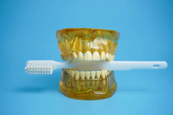 Dentures with a toothbrush on a blue background.Upper and lower jaws with false teeth. Dentures or false teeth, close-up.
