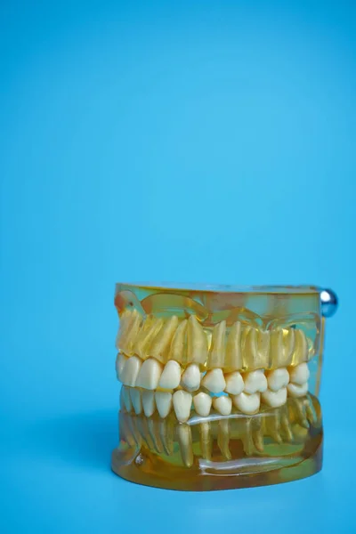 Dentures on a blue background.Upper and lower jaws with false teeth. Dentures or false teeth, close-up.