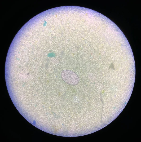 Parásitos Huevo Anquilostoma Fueron Encontrados Examen Microscópico 40X Heces Humanas —  Fotos de Stock