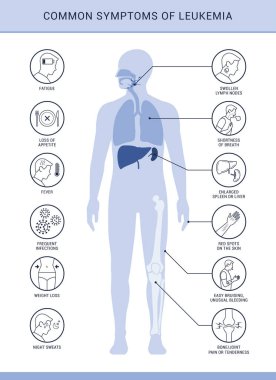 Yaygın semptomlar ve lösemi belirtileri, simgelerle ilgili bilgiler