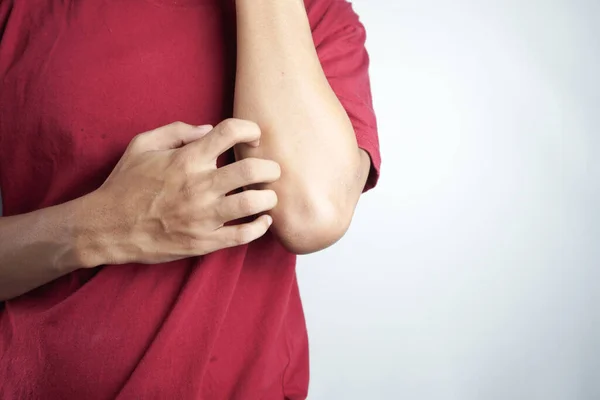 Cropped shot of young man scratching her forearm with fingers