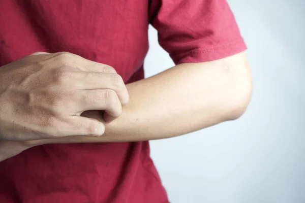 Cropped shot of young man scratching her forearm with fingers