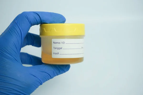 手持尿样容器进行医疗尿检 实验室里的尿液分析医疗尿检用于实验室分析的尿样 — 图库照片