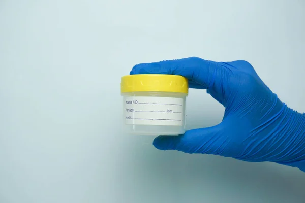 Tıbbi idrar tahlili için elinde idrar örneği kabı var. Laboratuvarda idrar tahlili. Tıbbi idrar testleri. Laboratuvar analizi için idrar örneği..