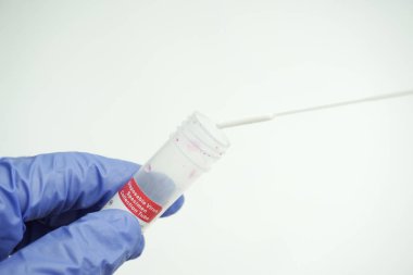 Cam test tüpü ve bir bilim adamının ellerinde pamuk çubuğu. Lastik tek kullanımlık eldivenler giyen bir virüs uzmanı laboratuvar şişesi tutuyor ve analiz için. Coronavirus testi için kan örneği aldı..