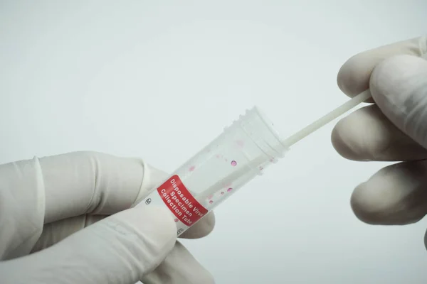 Trzymanie Jednorazowej Probówki Pobierania Próbek Wirusa Pobierać Próbki Kontroli Wirusów — Zdjęcie stockowe