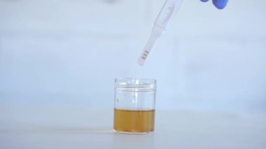 İdrar örneği konseptiyle idrar testi yapan bir tıp bilimcisi.