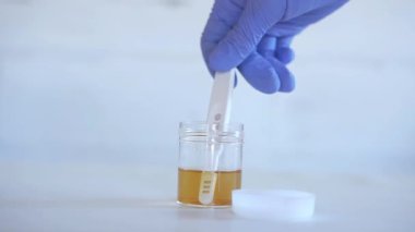 İdrar örneği konseptiyle idrar testi yapan bir tıp bilimcisi.